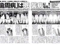 [FLASH] 電子版 2018 No.11.20 (福島雪菜 脊山麻理子 浅川梨奈 春花 他)