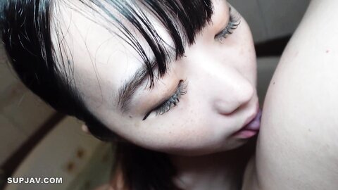 4771803 50% OFF!*Relief case [first time, face to face]**pzzyxqx*z* "My parents collapsed..." An 18-year-old potato girl with ultra-bald hair who made the decision to secure hospital expenses. She can`t stand