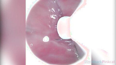 Camera Inside Vagina After Internal Creampie ส่องกล้องดูอสุจิในช่องคลอ