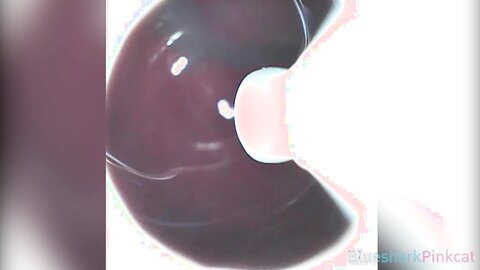 Camera Inside Vagina After Internal Creampie ส่องกล้องดูอสุจิในช่องคลอ