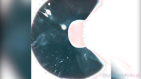 Camera Inside Vagina After Internal Creampie ส่องกล้องดูอสุจิในช่องคลอ
