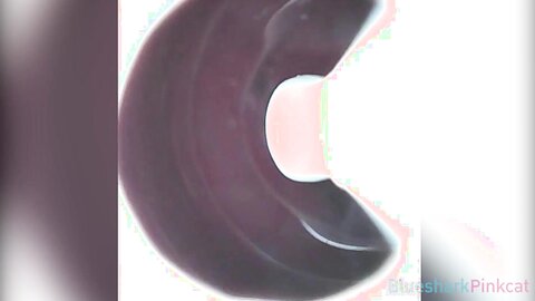 Camera Inside Vagina After Internal Creampie ส่องกล้องดูอสุจิในช่องคลอ