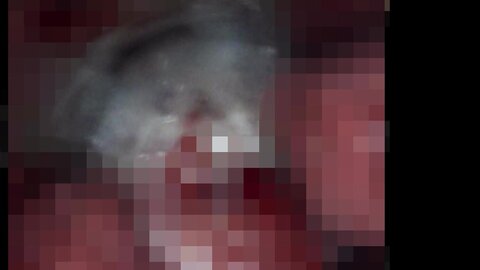PIYO-228 [4K] Chick 7th Anniversary. Genuine Nakadashi Super Impregnation Doctor. The 2nd Ward - The Diabolical...