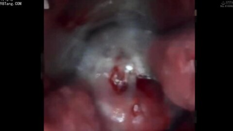 PIYO-228 [Uncensored] Chick 7th Anniversary. Genuine Nakadashi Super Impregnation Doctor. The 2nd Ward - The Diabolical...