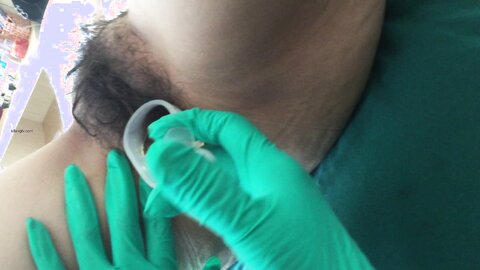 15 Live Filming Of Medical Vaginal Cleansing In Hotels Mandarin