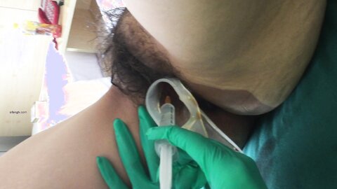 15 Live Filming Of Medical Vaginal Cleansing In Hotels Mandarin