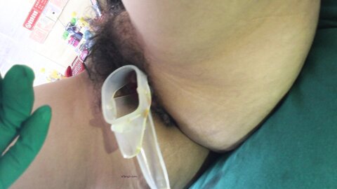 15 Live Filming Of Medical Vaginal Cleansing In Hotels Mandarin