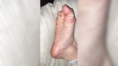277131780 A Few Hours After Taking Off The Foot Peeling Mask Enjoy M  01 8C7C368E 0315 4Eb7 890A 5B25A25Ae0F2