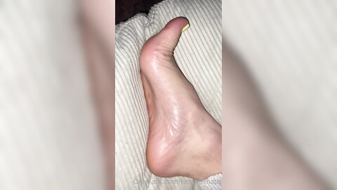 277131780 A Few Hours After Taking Off The Foot Peeling Mask Enjoy M  01 8C7C368E 0315 4Eb7 890A 5B25A25Ae0F2