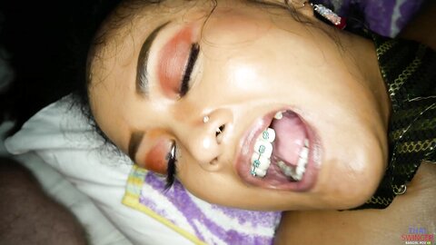 Anal Sex Big Load In Braces Mouth