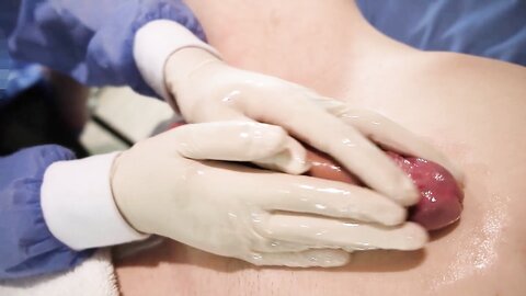 Day 8 The Two Nurses Almost Fought Over My Dick In Hospital